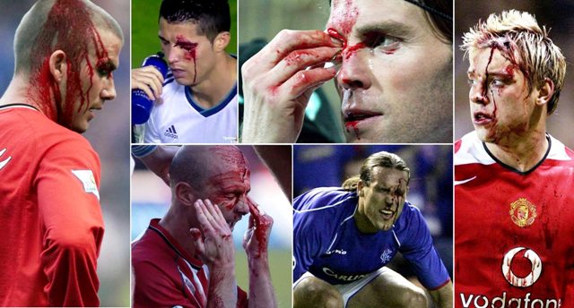 Mereka Tinggalkan Lapangan Bola Berlumuran Darah (II)